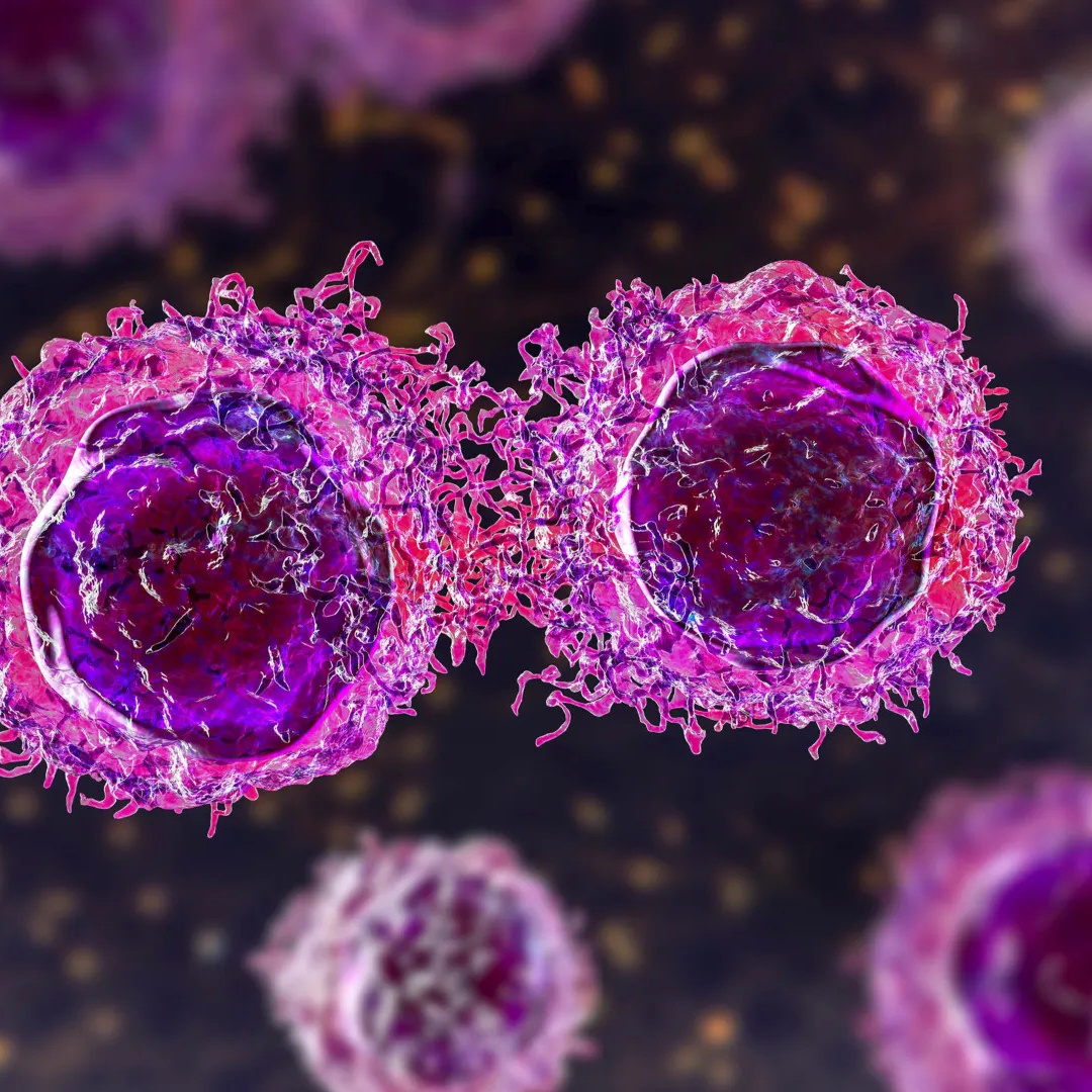 High Blood Sugar May Enhance Cancer Cells' Immune Evasion Through Sugar Coating